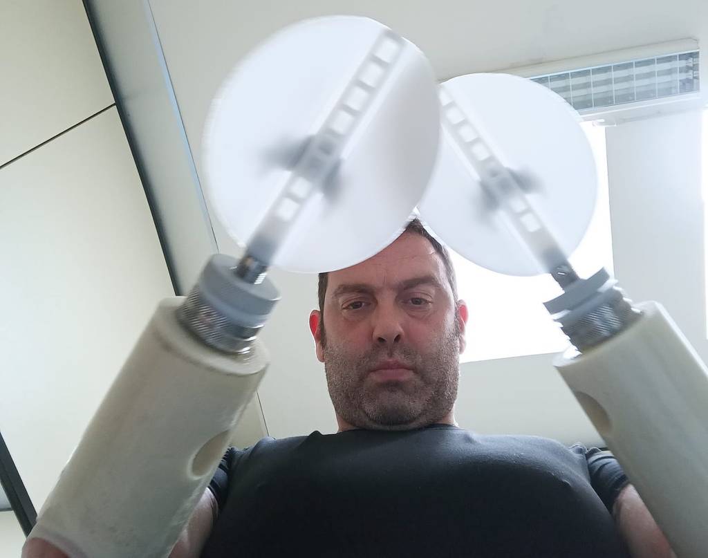 andrea lanari indossa le protesi