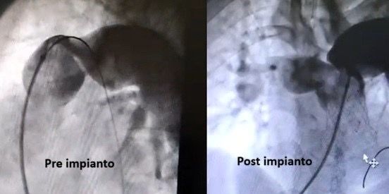 Intervento a Taormina